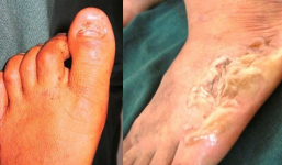 3 kẻ nhốt phụ nữ vào phòng kín rồi tra tấn như thời trung cổ